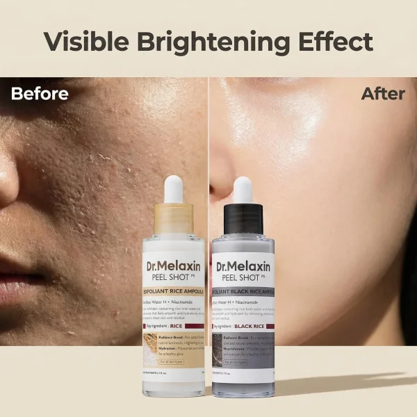 Black Rice Exfoliating Water Extract,